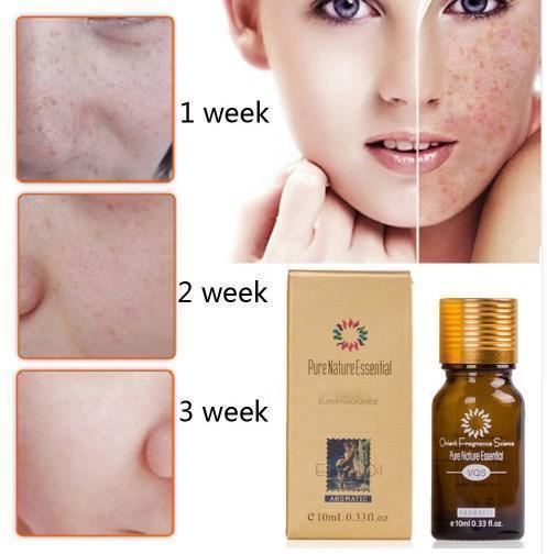 Pure Natural Essential Ultra Brightening Spotless Oil Dark Spots Fade Away Age Spots Hyper Pigmentation Essential Oil.