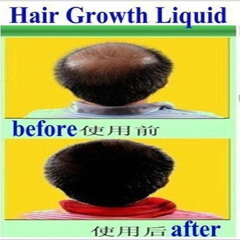 The Organic Hair Growth Essence